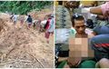 Seorang Pemotor Alami Nasib Sial, Kepala Dapat 10 Jahitan, Motornya Jatuh ke Jurang Karena Longsor