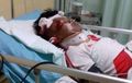 Korban Salah Sasaran Gengster Tergeletak di Rumah Sakit, Dipukul Batu Saat Naik Motor, Kekurangan Dana Pengobatan Karena Tak Ditanggung BPJS