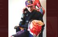 Update Kondisi Marc Marquez Setelah Pemeriksaan di Rumah Sakit, Begini Kondisinya