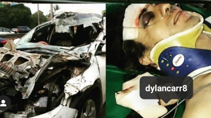 Beredar foto yang disebut kondisi pesinetron Dylan Carr usai kecelakaan