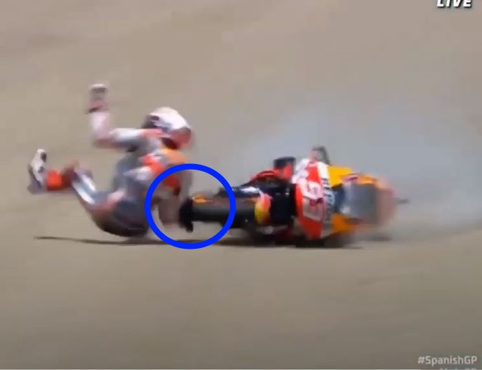 Tangan Marc Marquez terkena ban depan