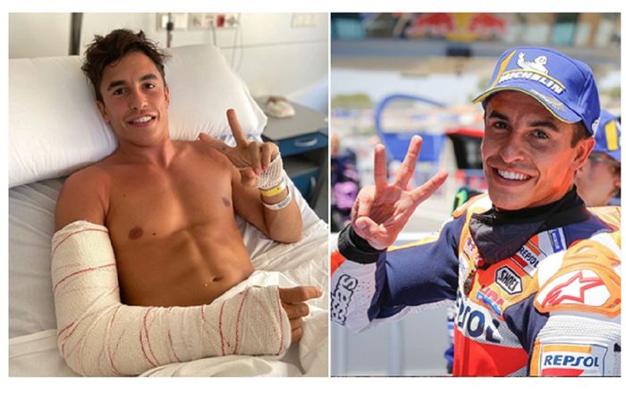 Marc Marquez merasa pulih lebih cepat dari perkiraan dan berniat segera kembali beraksi di MotoGP Andalusia 2020.