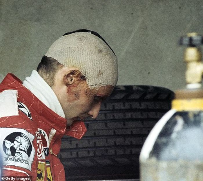 Niki Lauda kembali setelah crash mengerikan di Nurburgring
