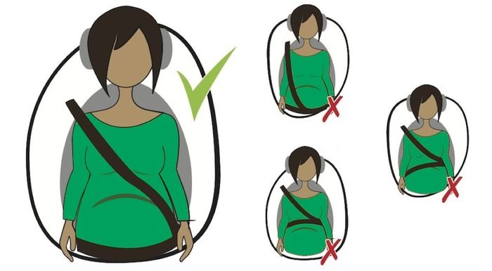 Ilustrasi penggunaan sabuk pnegaman pada ibu hamil