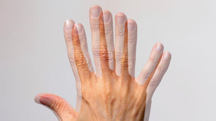 Ilustrasi obyek yang dilihat penderita Diplopia