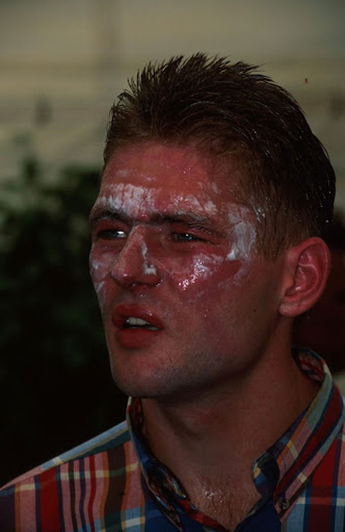Wajah Jos Verstappen usai insiden F1 Jerman 1994