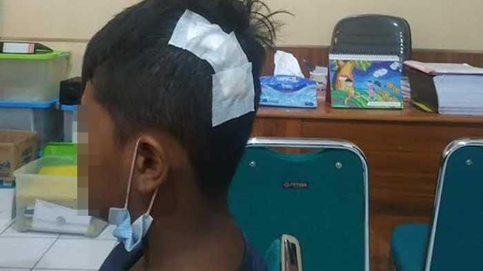 Bocah kelas 6 SD di Kota Madiun yang dianiaya menggunakan kunci motor