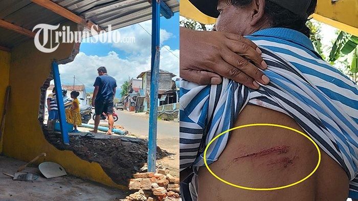Kondisi punggung Hardianto terluka kena reruntuhan tembok warung soto yang jebol diseruduk Toyota Avanza di Karanpandan, Karanganyar