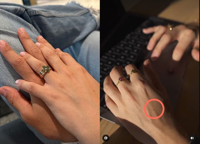 Bukti tahi lalat tangan tersebut milik Gemma Pinto