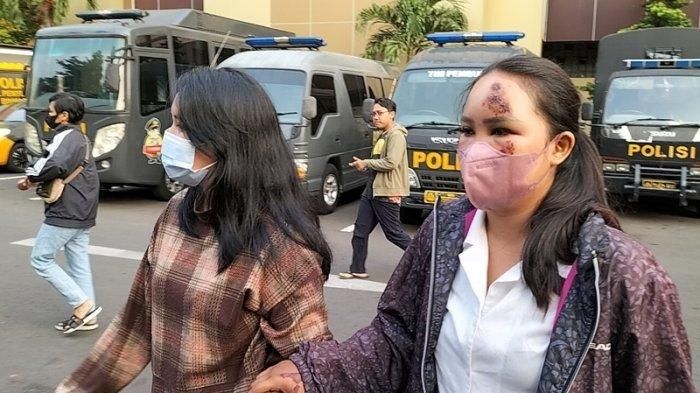 Dyah Ambar Wulan (22) dengan kondisi wajah terluka melaporkan pacarnya karena menabrak dirinya menggunakan mobil