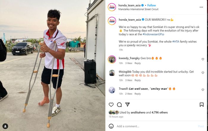 Tampak kaki kanan Somkiat dibalut akibat insiden