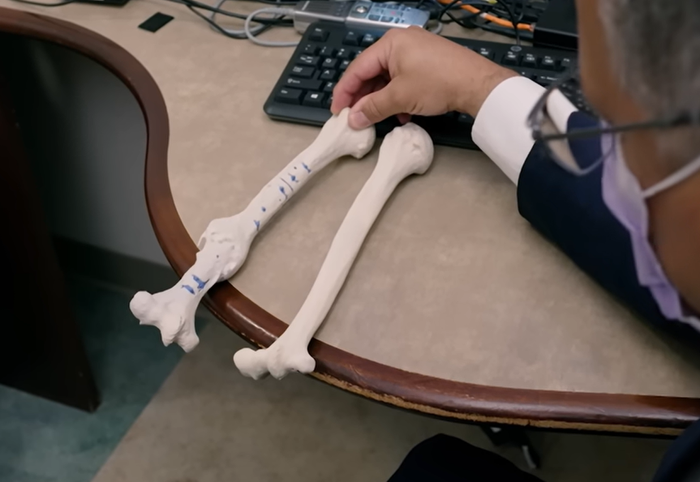 Rotasi tulang humerus Marc Marquez melenceng 34 derajat dari normal