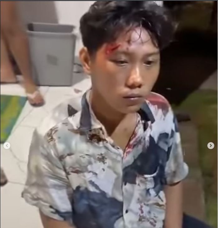 Salah satu wisatawan asal Surabaya yang menjadi korban pengeroyokan oleh orang tak dikenal di Pantai Wediawu, kabupaten Malang, Jawa Timur, (5/5/26) dinihari