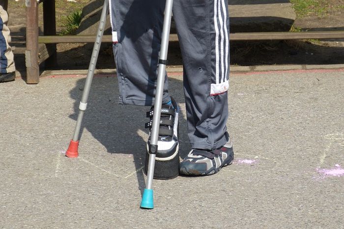 Ilustrasi disabiltas pada kaki akibat kecelakaan