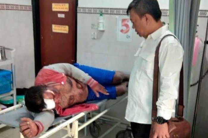 Wawan saat dirawat di sebuah rumah sakit di Kota Surabaya, Senin (14/10/2019). 