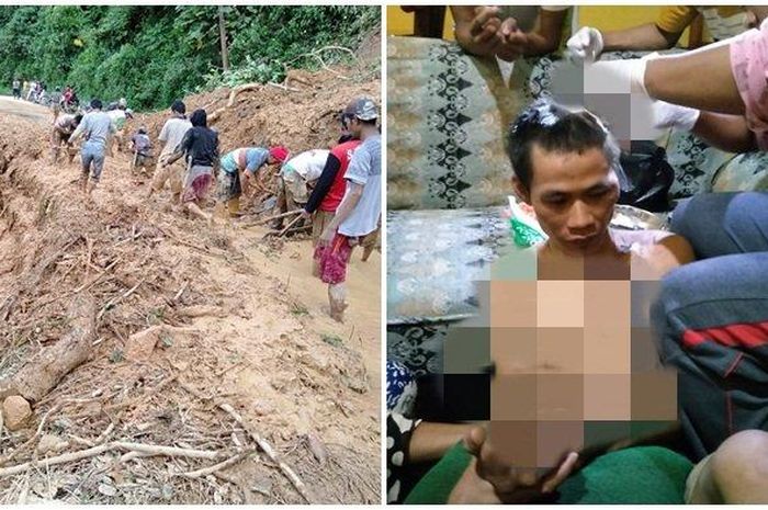 Korban Juniasnyah (25) warga Desa Anugerah Kemu Kecamatan Pulau Beringin, OKU Selataj saat menjalani perawatan di Puskesmas, Sabtu (9/5/2020). 