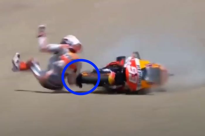 Tangan Marc Marquez terkena ban depan