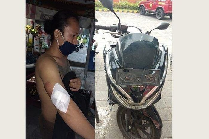 Korban selamat kecelakaan saat mengendarai Honda PCX dalam pengaruh minuman keras