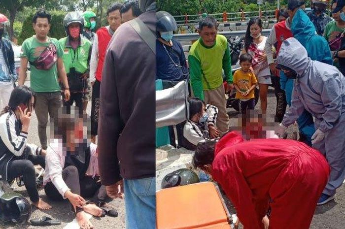 Korban penjambretan di Tapak Siring Surabaya alami luka bagian wajah, Kamis (21/1/2021).  