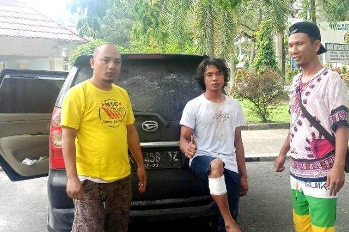 Maling mobil bernama Putra warga asal Riau saat diminta berpose setelah kakinya ditembus timah panas polisi,  (10/5/2021).
