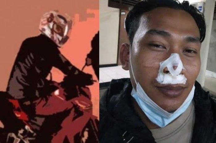 Bripka Firman ,  bibir dan hidung dijahit akibat luka saat tangkap penjahat