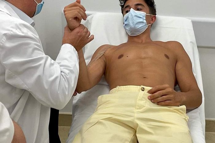 Marc Marquez sudah melepas penyangga tangan kanannya