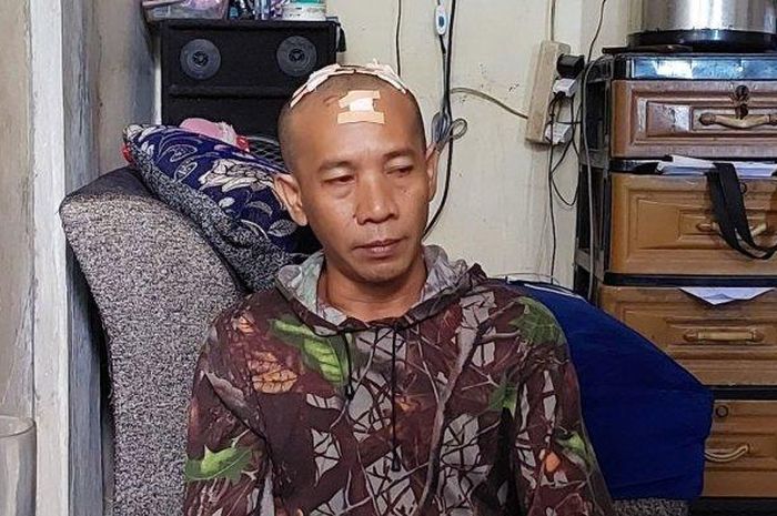 Ujang Usman (42), sopir taksi online yang mendapat 27 jahitan setelah duel lawan rampok di Tambun Utara, Bekasi, Jawa Barat