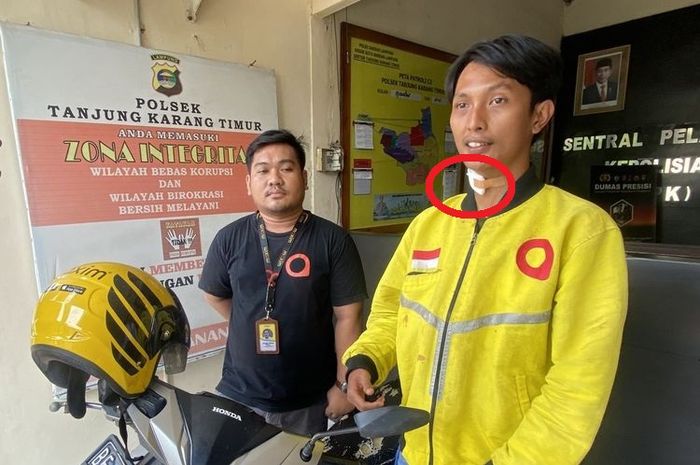 Rizki Hidayat (24), pengendara ojek online yang selamat dari begal meski sudah dikalungi golok di leher