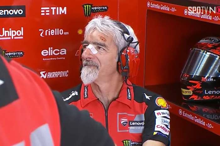 General Manager Ducati Corse, Luigi Dall'Igna tertangkap punya banyak luka di sirkuit Mandalika