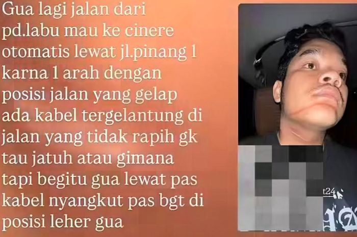 Cerita pengendara motor bernama Bawi yang menjadi korban ranjau kabel WiFi menjuntai di Jl Pinang I, Pondok Labu, Jakarta Selatan, dagu dan lehernya terjerat hingga memar kemerahan