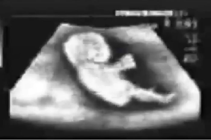 Janin tiru gaya pembalap