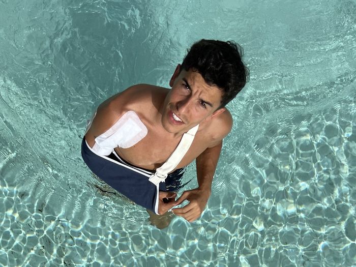 Marc Marquez memperlihatkan kondisi lengan tangan kanannya setelah menjalani operasi keempat awal Juni 2022 lalu