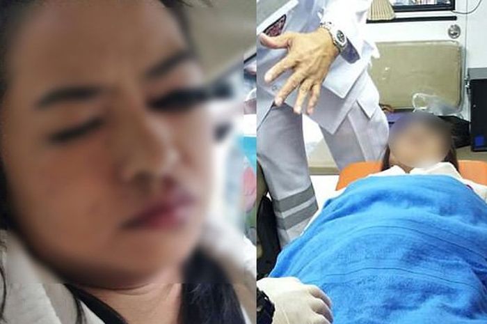 Akibat make up di dalam mobil bola tertancap 