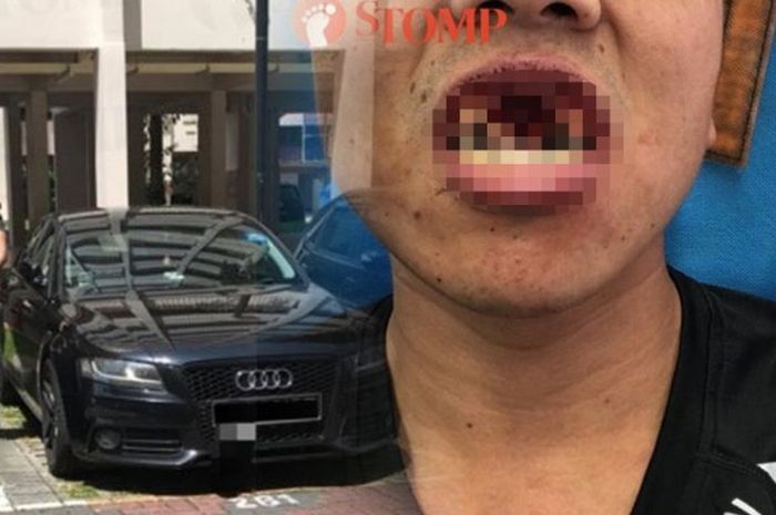 calon penumpang dipukul wajahnya oleh sopir taksi online karena alasan yang tak masuk akal