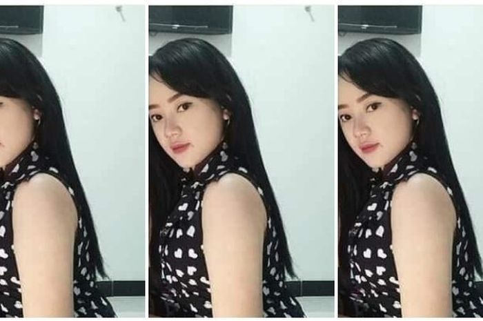 Model Rini Puspitawati kondisinya sudah membaik