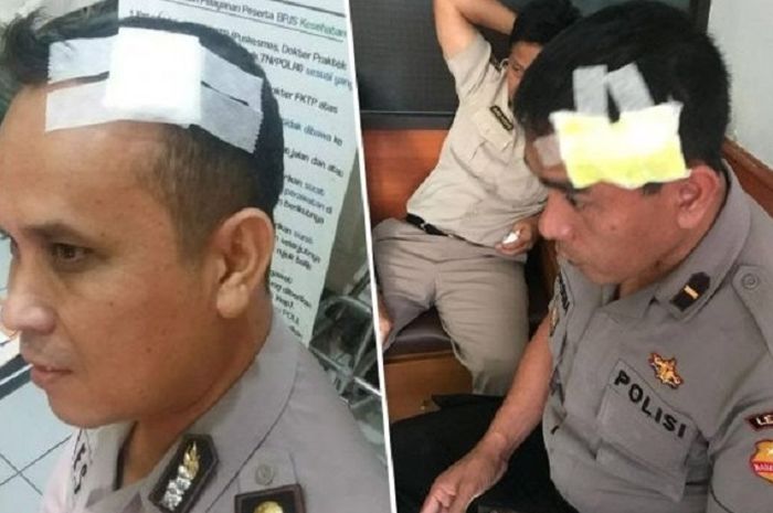 Anggota polisi yang terluka di kepala akibat dipukul pakai helm oleh perwira menengah polisi.