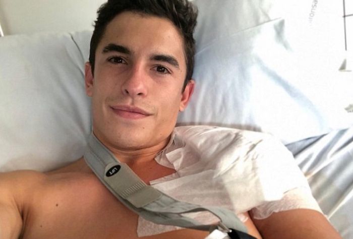 Marc Marquez saat menjalani operasi cedera bahu kiri, saat ini bahu kanannya juga cedera usai terjatuh di tes pramusim MotoGP 2020.