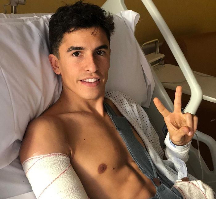 Marc Marquez setelah menjalani operasi ketiganya.