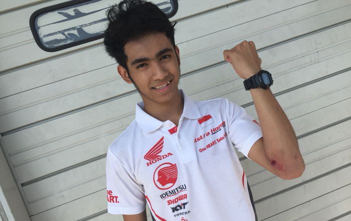 Setelah terjatuh keras, Andi Gilang tidak cedera serius