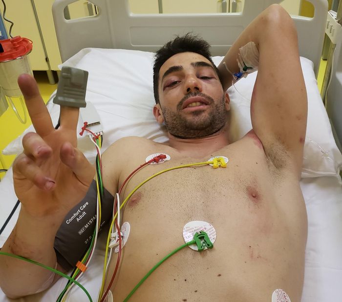 Michele Pirro setelah mendapat penanganan medis