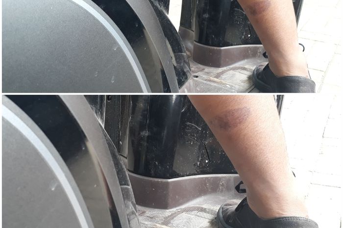 Ini dia flek hitam akibat terkena Knalpot