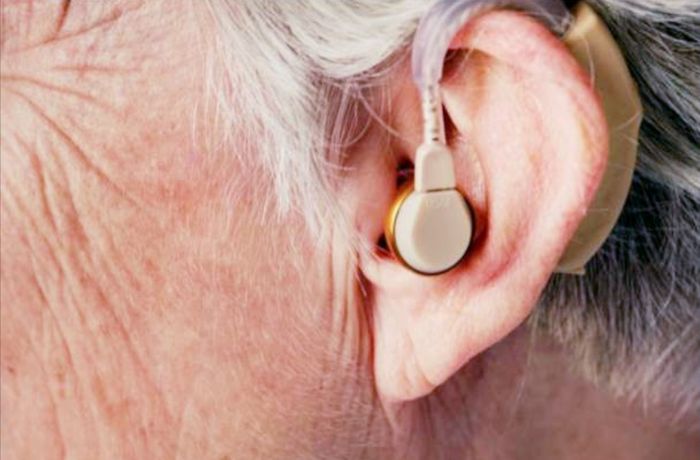 Ilustrasi alat bantu pendengaran