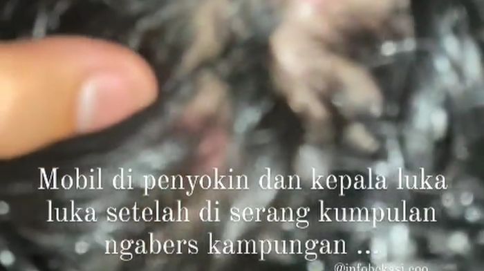 Kepala teman korban alami luka dibagian kepala 