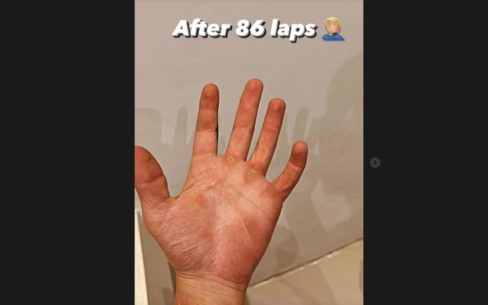Kondisi telapak tangan Fabio Quartararo setelah melibas 86 lap di hari pertama tes MotoGP 2022 di sirkuit Mandalika