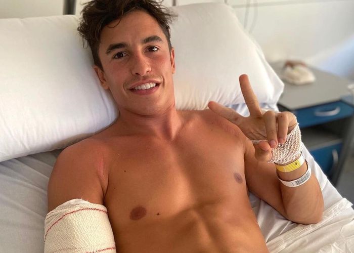 Apa Akibat Dari Patah Tulang Lengan Yang Dialami Marc Marquez Dalam Waktu Dekat Gridoto Com
