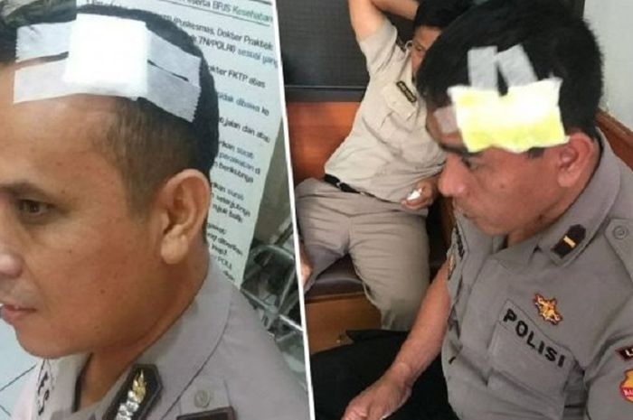Anggota polisi yang terluka di bagian kepala akibat dipukul pakai perwira menengah polisi pakai helm