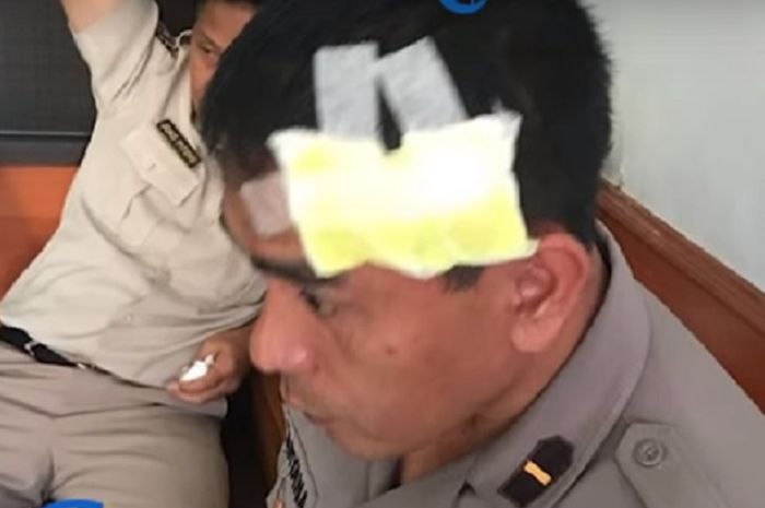 Seorang polisi korban pemukulan perwira menengah polisi.