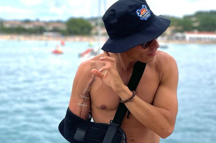 Meski masih terlihat bekas luka, Marc Marquez sudah tidak rasakan sakit yang berat di lengan kanannya. Sudah bisa liburan juga. 