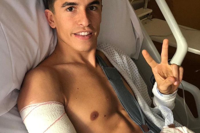 Sebab, Marquez baru saja menjalani operasi ketiga guna menyembuhkan cedera pada lengan kanannya pada awal Desember lalu