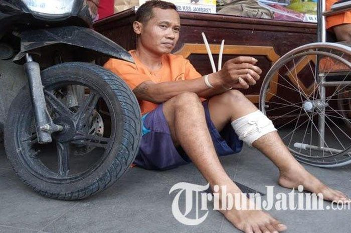 Zubaidin (37), tersangka jambret masih bersikap santai, meski kakinya ditembak. 